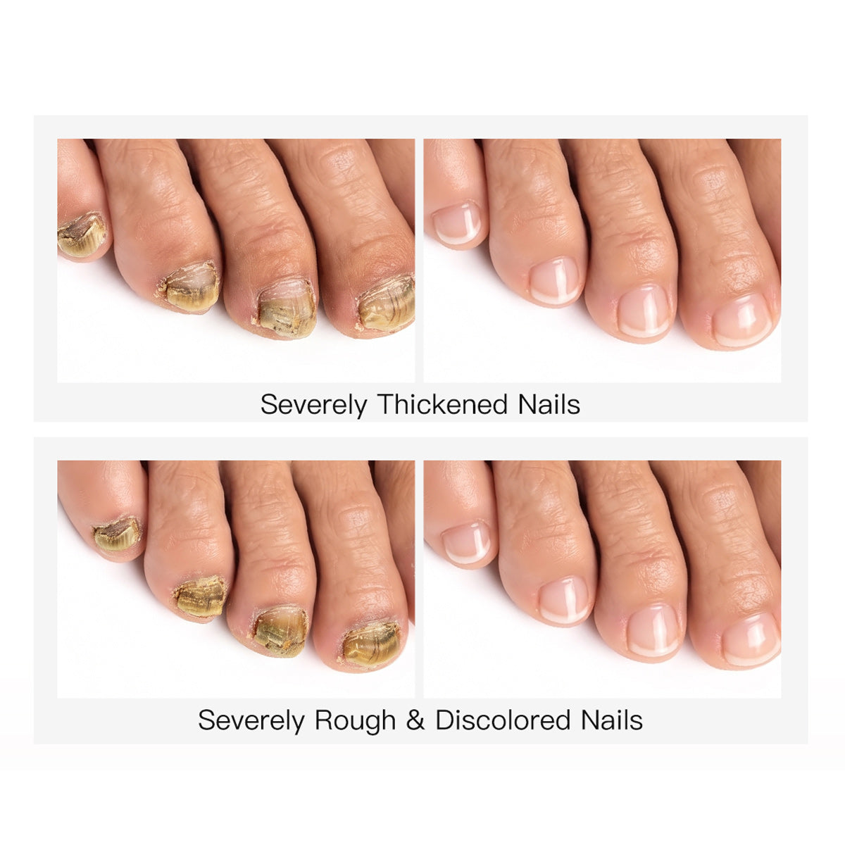 28-Day Wear No Chipping No Yellowing No Lifting