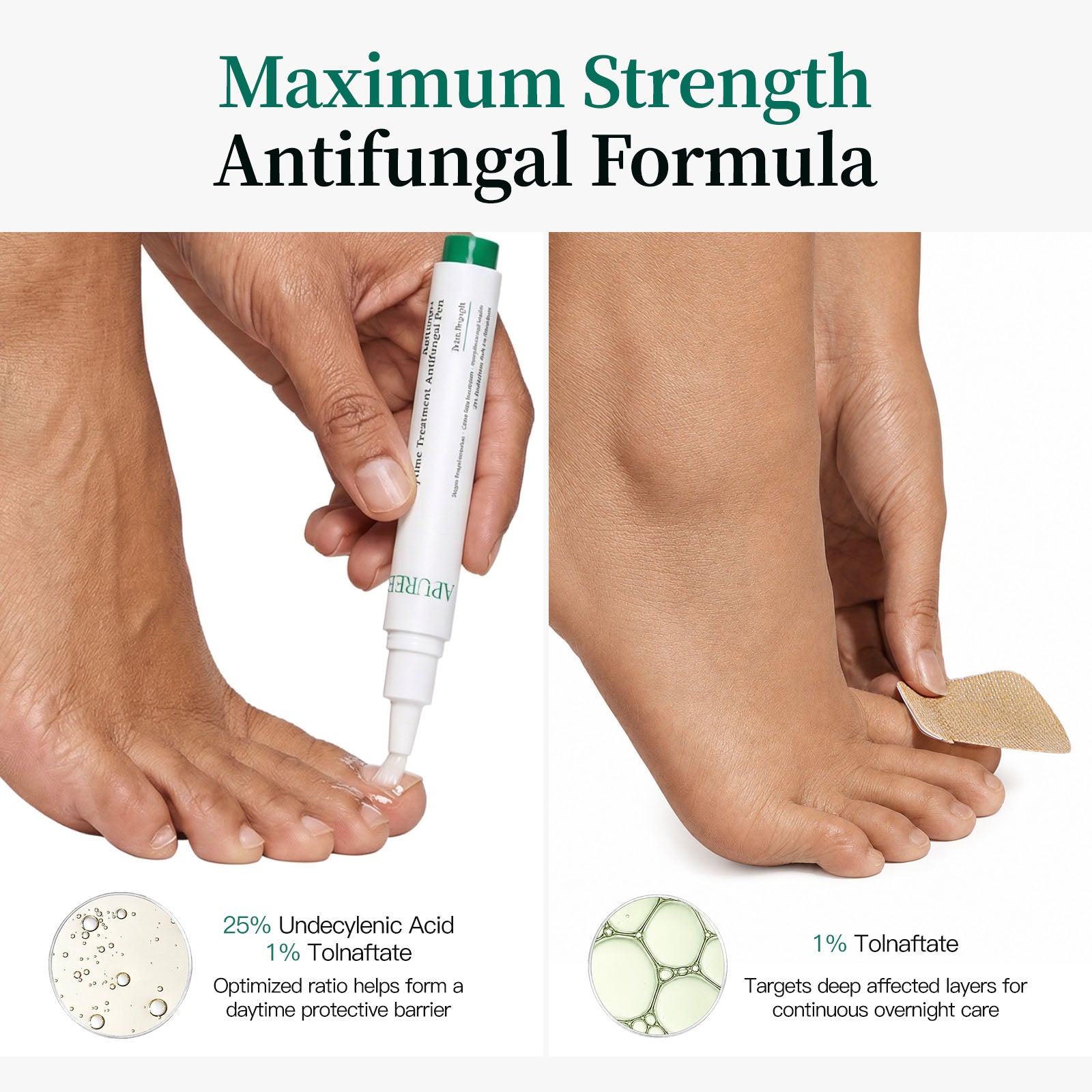 Antifungal Pen & Patch Kit with 26-Free, Maximum-Strength Formula