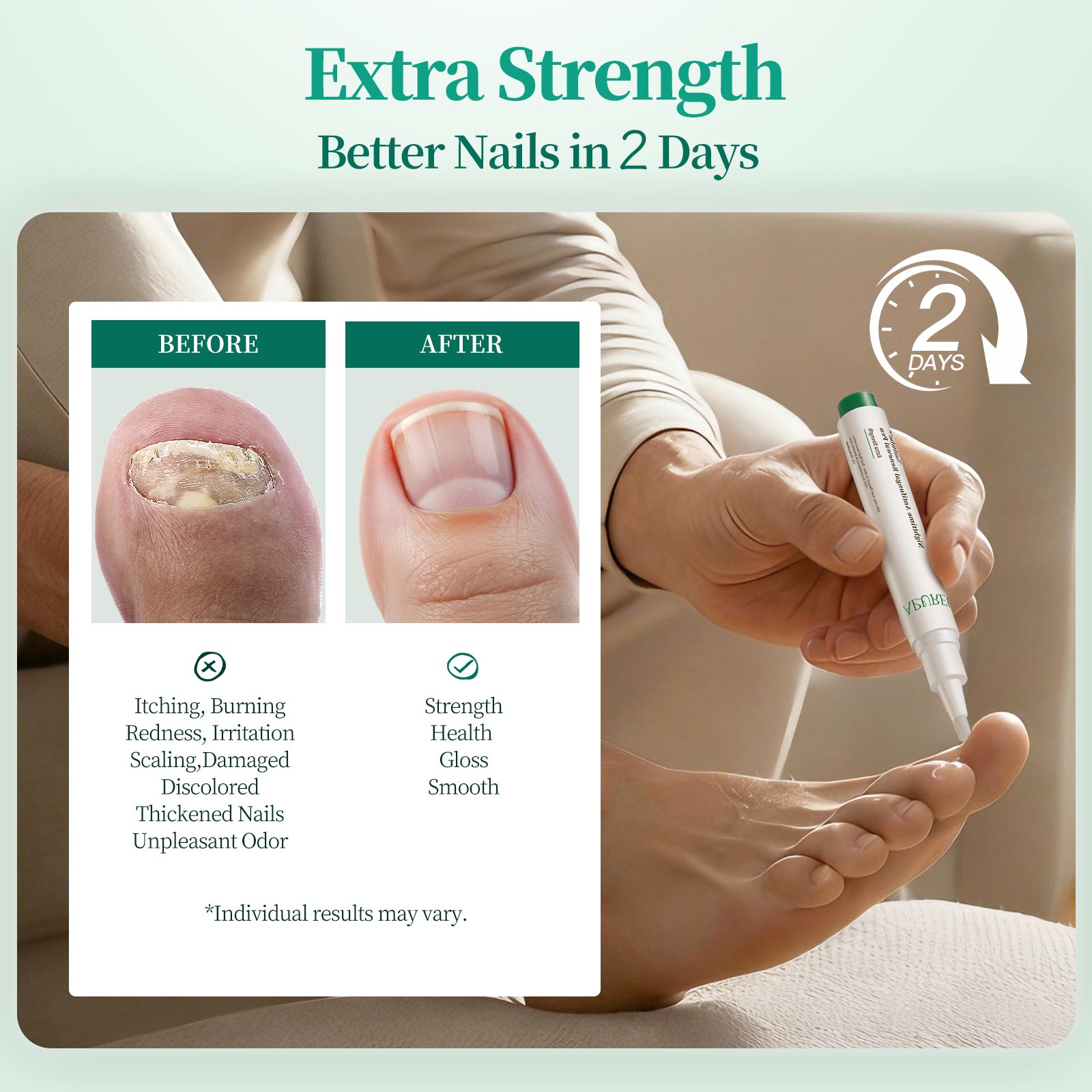 Apuree Nailtific OTC Antifungal Solution For Toenail