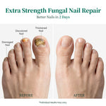 Apuree toenail fungus treatment before and after results overnight deep nail repair improvement