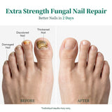 Apuree toenail fungus treatment before and after results overnight deep nail repair improvement
