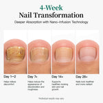 APUREE nail fungus patches pro four-week nail changes