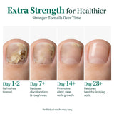 APUREE antifungal undecylenic acid treatment showing nail improvement timeline day 1 to day 28