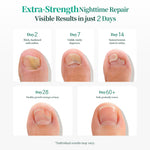 Apuree overnight nail repair results timeline showing visible improvement of damaged nails over 2 to 60 days