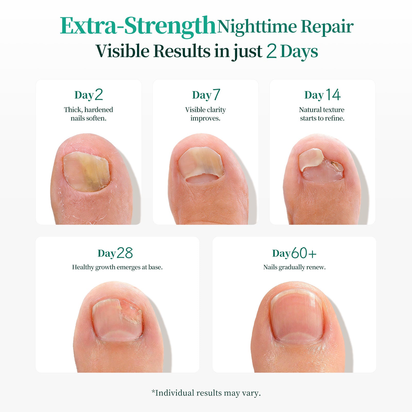 Apuree overnight nail repair results timeline showing visible improvement of damaged nails over 2 to 60 days