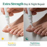 Apuree daytime and nighttime antifungal pen routine for continuous toenail fungus treatment system