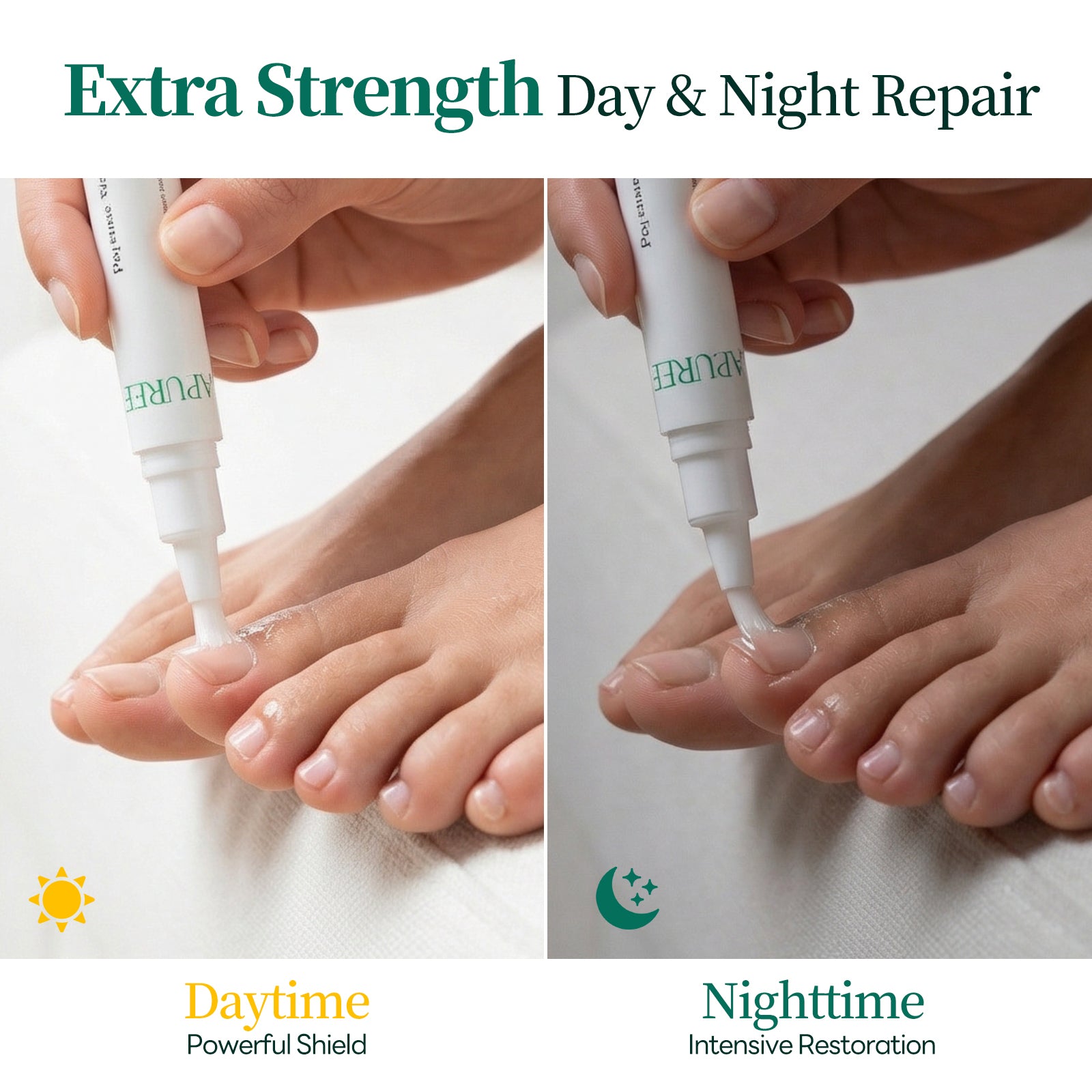 Apuree daytime and nighttime antifungal pen routine for continuous toenail fungus treatment system