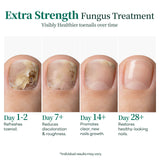 Apuree toenail fungus treatment progress timeline daytime use visible nail recovery stages