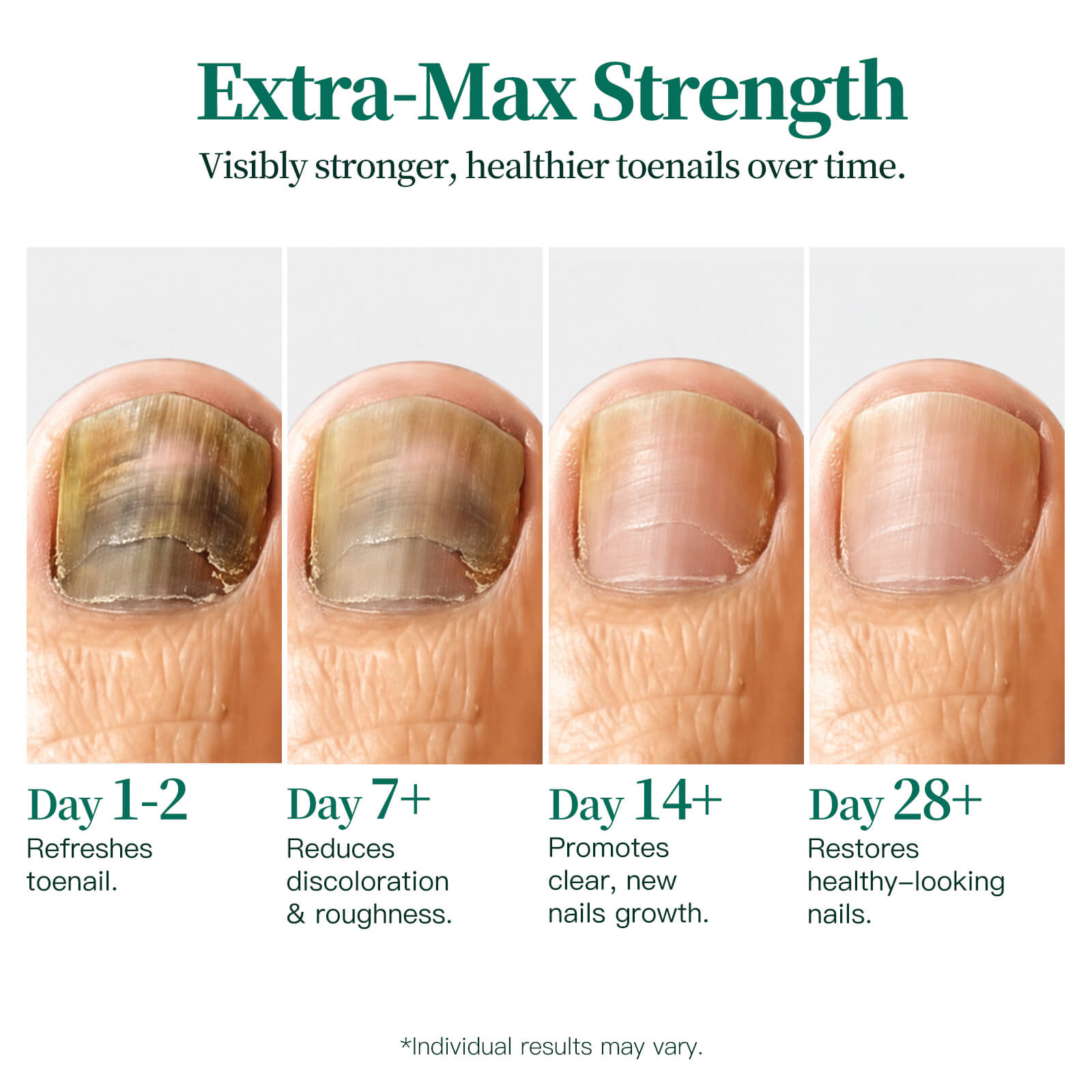 APUREE Pure Clean Safety nail recovery showing healthier and clearer toenails over time