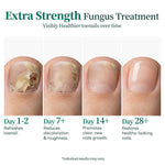 Apuree toenail fungus treatment progress timeline overnight repair visible nail recovery stages