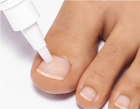 APUREE daytime antifungal pen application