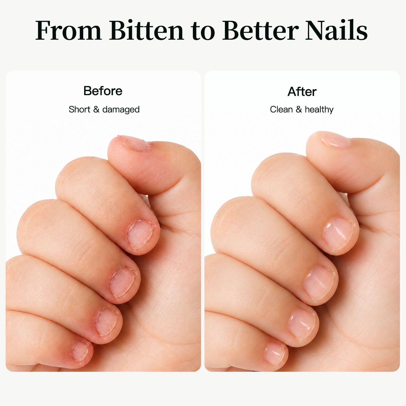 APUREE bitter nail polish for nail biters kids