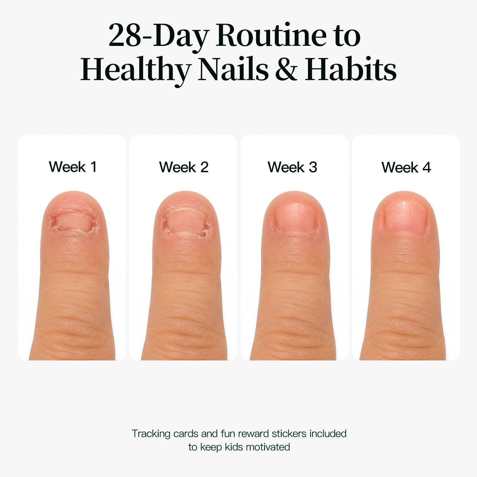 APUREE thumb sucking deterrent with 28-day tracking