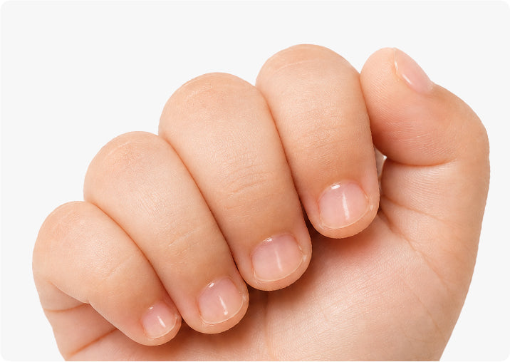Clean healthy-looking nails after APUREE Nail Biting Treatment Pen dries